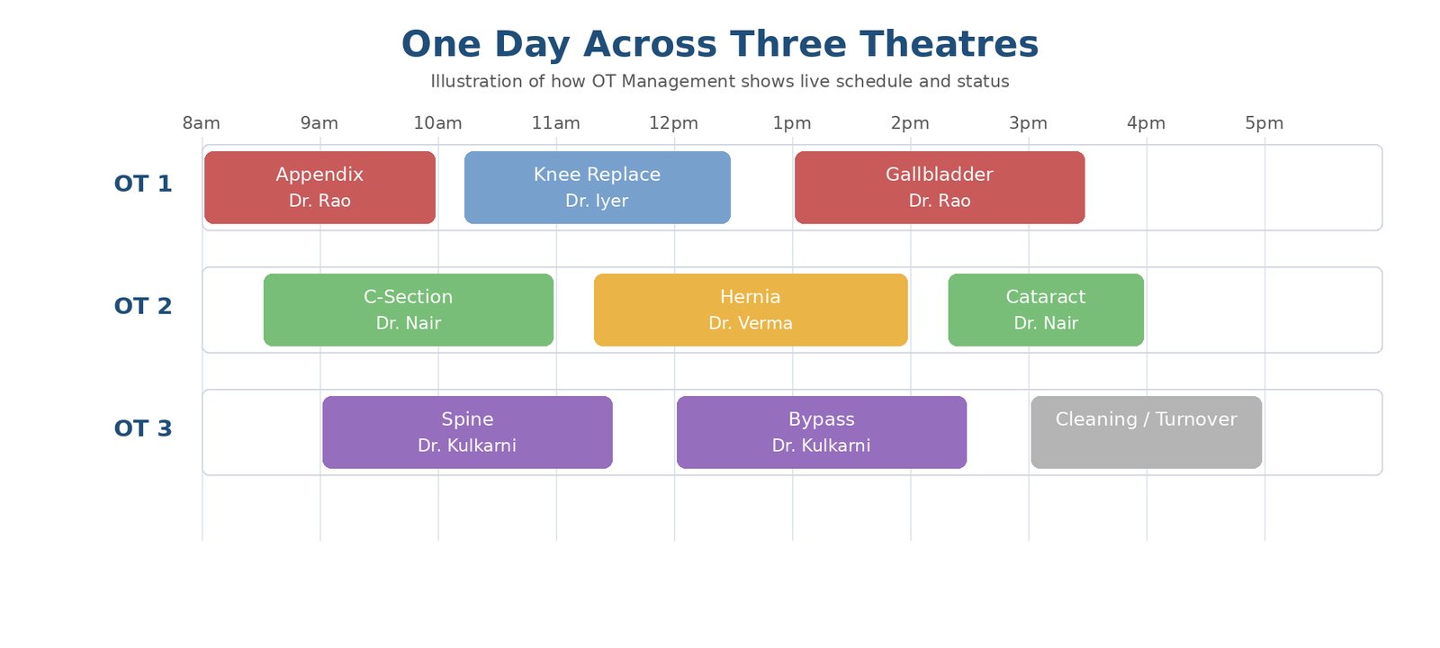Illustration of an operation theatre schedule showing three theatres and their surgeries across a day